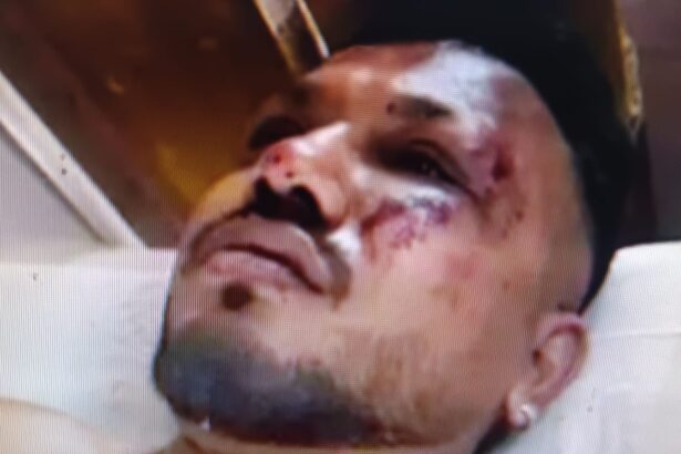 ವಿಮಾನದಲ್ಲಿ ಓರ್ವ ಮಾತ್ರ ಪವಾಡ ಸದೃಶ್ಯವಾಗಿ ಬದುಕುಳಿದ