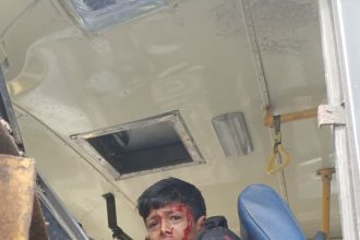 ಲಾರಿ ಬಸ್ ಡಿಕ್ಕಿ ಪ್ರಯಾಣಿಕರಿಗೆ ಗಂಬೀರ ಗಾಯ