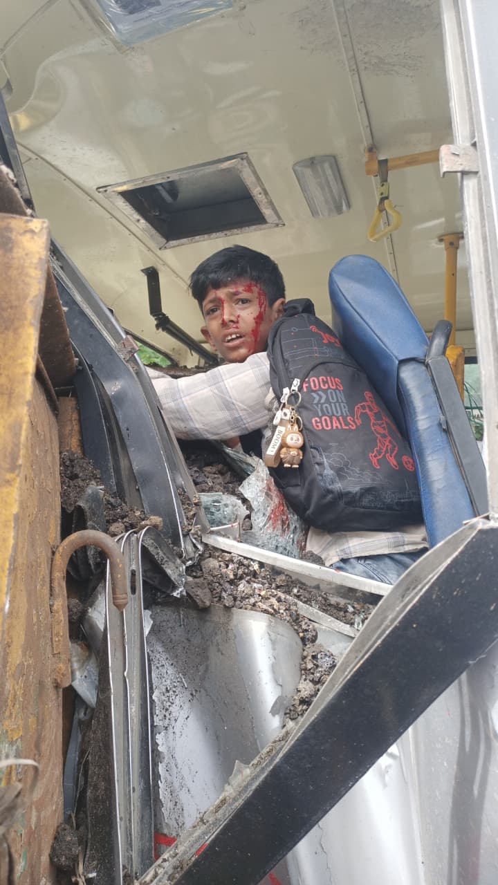 ಲಾರಿ ಬಸ್ ಡಿಕ್ಕಿ ಪ್ರಯಾಣಿಕರಿಗೆ ಗಂಬೀರ ಗಾಯ