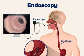ಜಿಲ್ಲಾಸ್ಪತ್ರೆಯಲ್ಲಿ ಮೆಮೋಗ್ರಾಫಿ, ಎಂಡೋಸ್ಕೋಪಿ ಸೌಲಭ್ಯ ಪ್ರಾರಂಭ