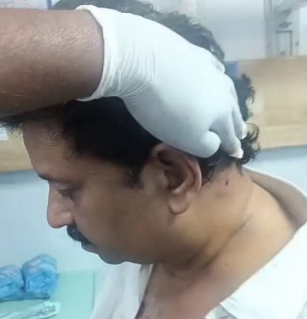 ಉದ್ಯಮಿ ಮೇಲೆ ಏರ್ ಗನ್ ಫೈರಿಂಗ್