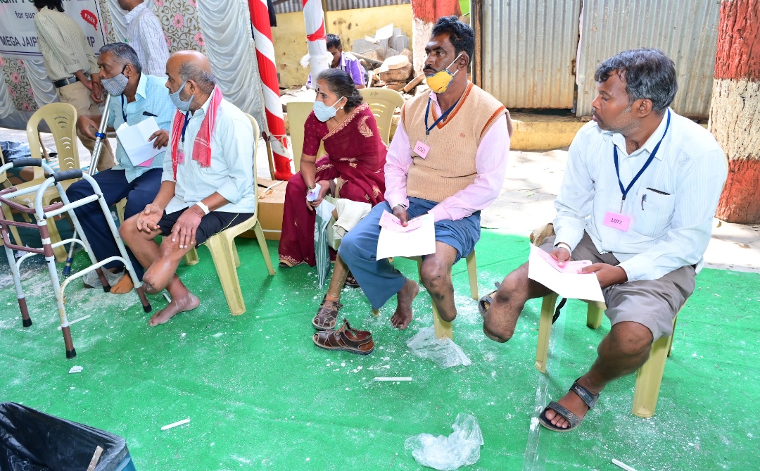 ಜನವರಿ-3 ರಿಂದ 9 ರವರೆಗೆ ಉಚಿತ ಕೃತಕ ಕಾಲು, ಕ್ಯಾಲಿಪರ್, ಮುಂಗೈ ಜೋಡಣಾ ಶಿಬಿರ