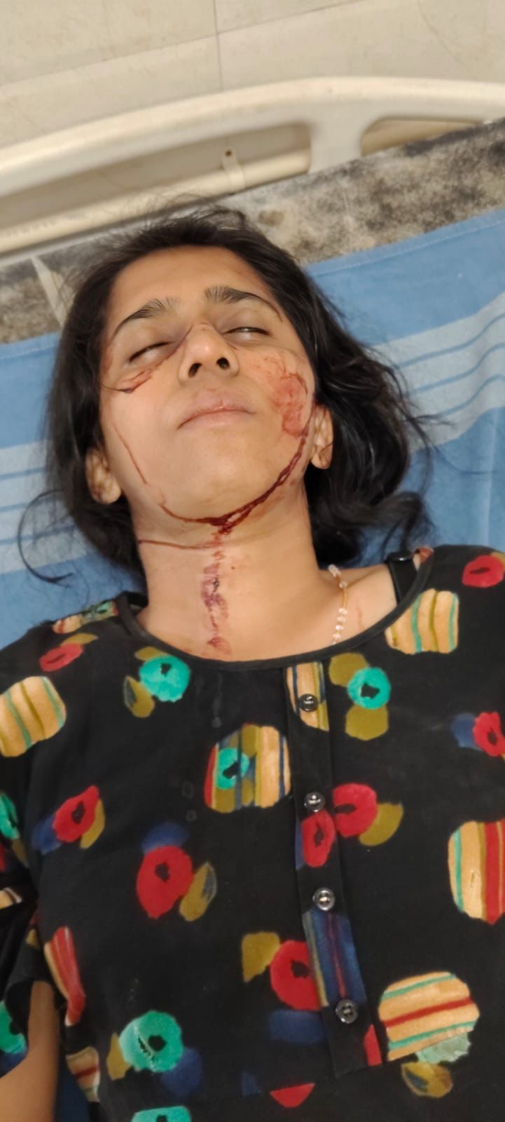 ವಿದ್ಯಾರ್ಥಿಗಳ ಗಲಾಟೆ ಒಂಬತ್ತನೇ ತರಗತಿ ವಿದ್ಯಾರ್ಥಿ ಸಾವು, ವಾರ್ಡನ್ ಸೇರಿ 7 ವಿದ್ಯಾರ್ಥಿಗಳಿಗೆ ಗಾಯ