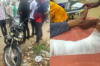 ನಿಲ್ಲದ ರಸ್ತೆ ಅಪಘಾತ : ಮತ್ತೆ ಆಕ್ಸಿಡೆಂಟ್ ಮಹಿಳೆಗೆ ಕಾಲು ಮುರಿತ