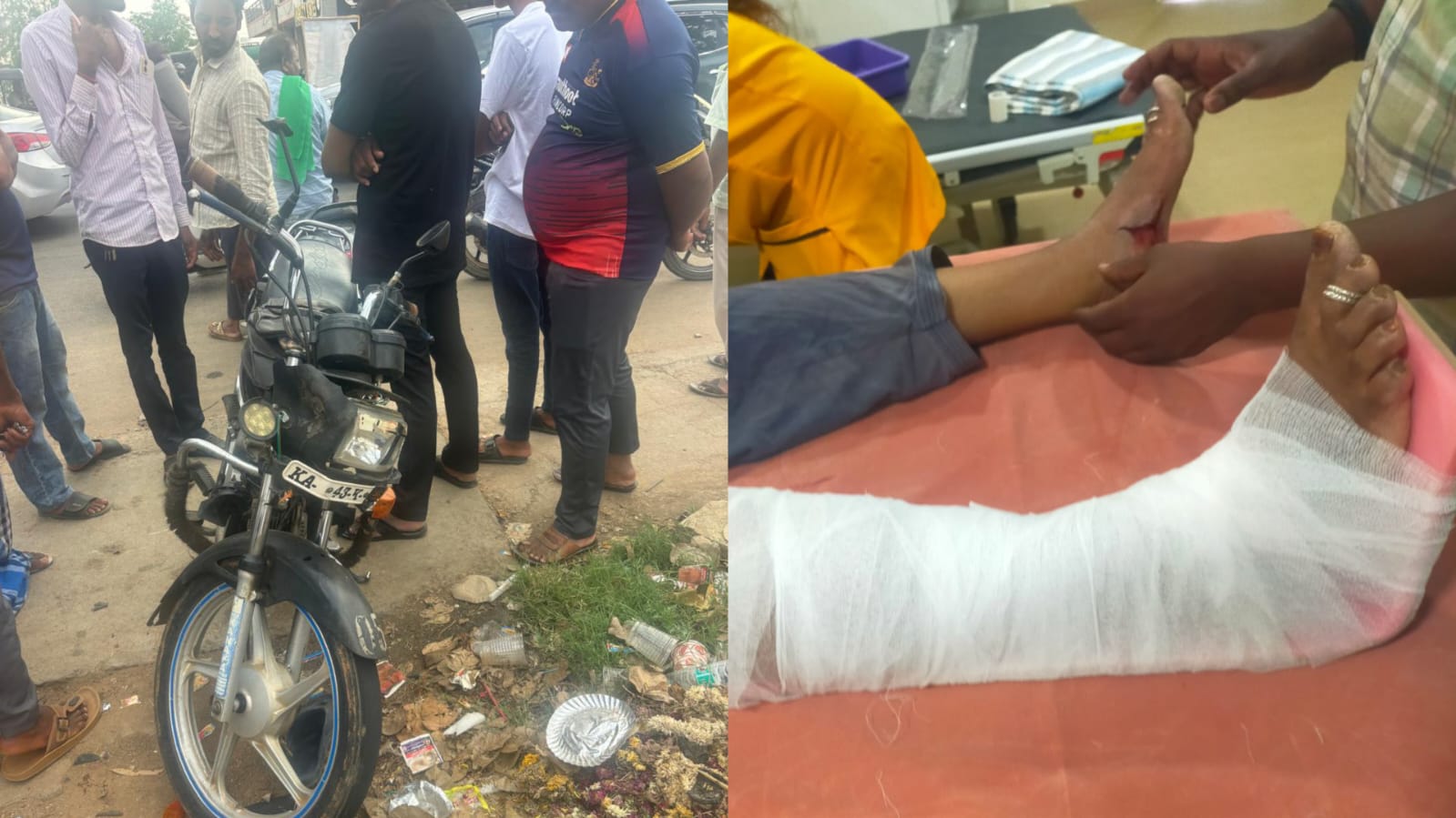 ನಿಲ್ಲದ ರಸ್ತೆ ಅಪಘಾತ : ಮತ್ತೆ ಆಕ್ಸಿಡೆಂಟ್ ಮಹಿಳೆಗೆ ಕಾಲು ಮುರಿತ